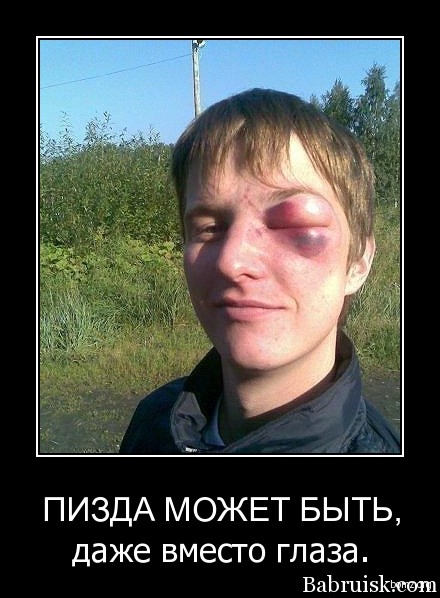 пизда вместо глаза